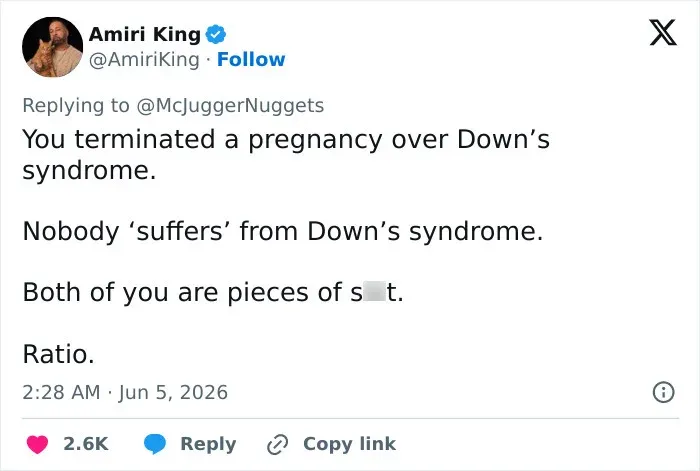 Harsh criticism from viewers about terminating Down syndrome pregnancy