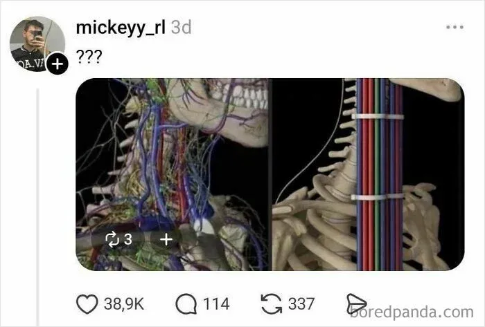 Medical illustration of neck skeletal and vascular anatomy compared